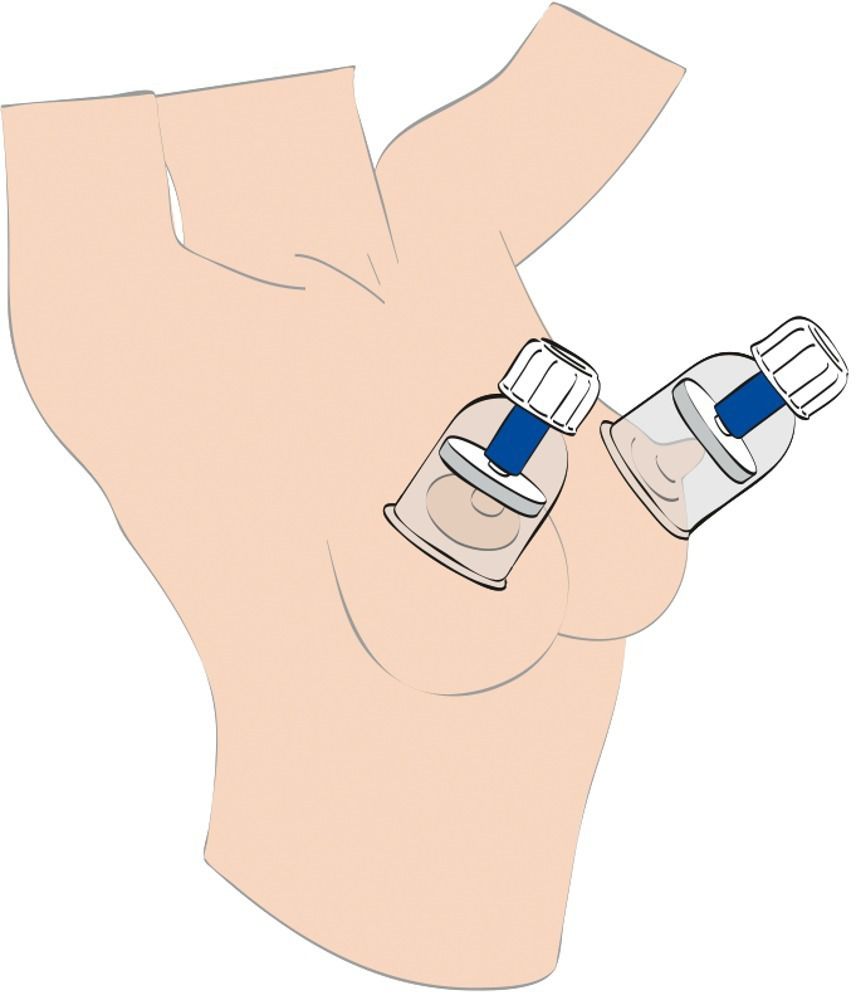 Поршневые помпы для сосков - фото 142633 Поршневые помпы для сосков - фото 142633