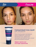 Салициловый гель-скраб для умывания Noproblem - 100 мл. 517303