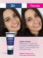 Салициловая крем-пенка для умывания Noproblem - 100 мл. 517304