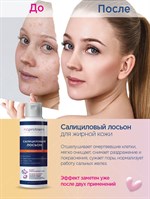 Салициловый лосьон для жирной кожи  Noproblem - 120 мл. 517319
